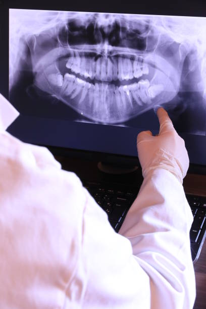Best Emergency Broken Tooth Repair in Aberdeen, SD